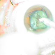 ΔΙΑΠΙΣΤΩΝΕΤΑΙ Η ΡΗΞΗ ΤΟΥ ΟΠ.ΠΕΡΙΦΑΚΙΟΥ