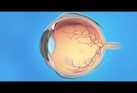 Κεντρική Απόφραξη Φλέβας Αμφιβληστροειδους